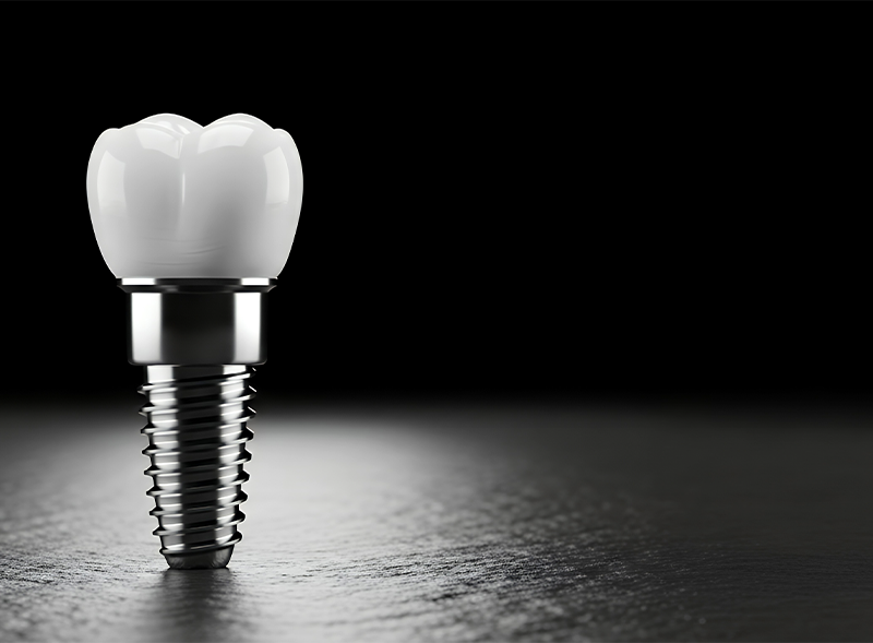 single dental implant